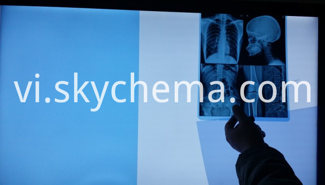 phim laser y tế 7-3 medical laser film 7-3